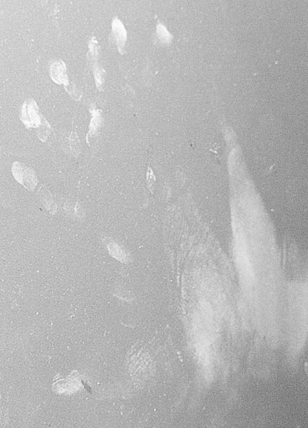 File:6fingeredhand.jpg